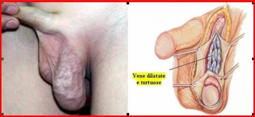 Don Ekaterina Dmitriyevna è risposte phlebologist