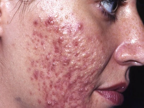 Olio di faccia di albicocca da risposte di posti