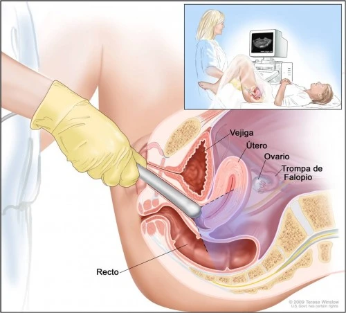  ECOGRAFIA TRANSVAGINALE Roma